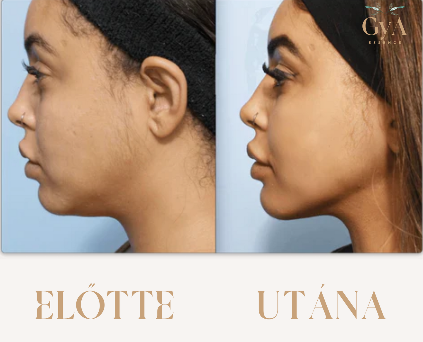 GyA Essence Contour