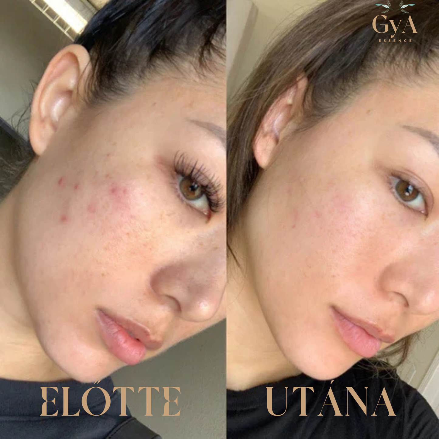 GyA Essence Contour