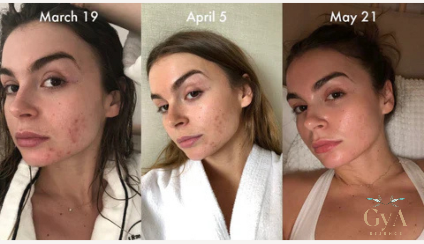 GyA Essence Contour